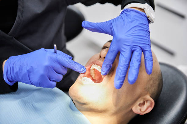 Best Emergency Tooth Extraction in Healdton, OK