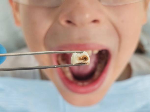Best After-Hours Emergency Dentist in Healdton, OK